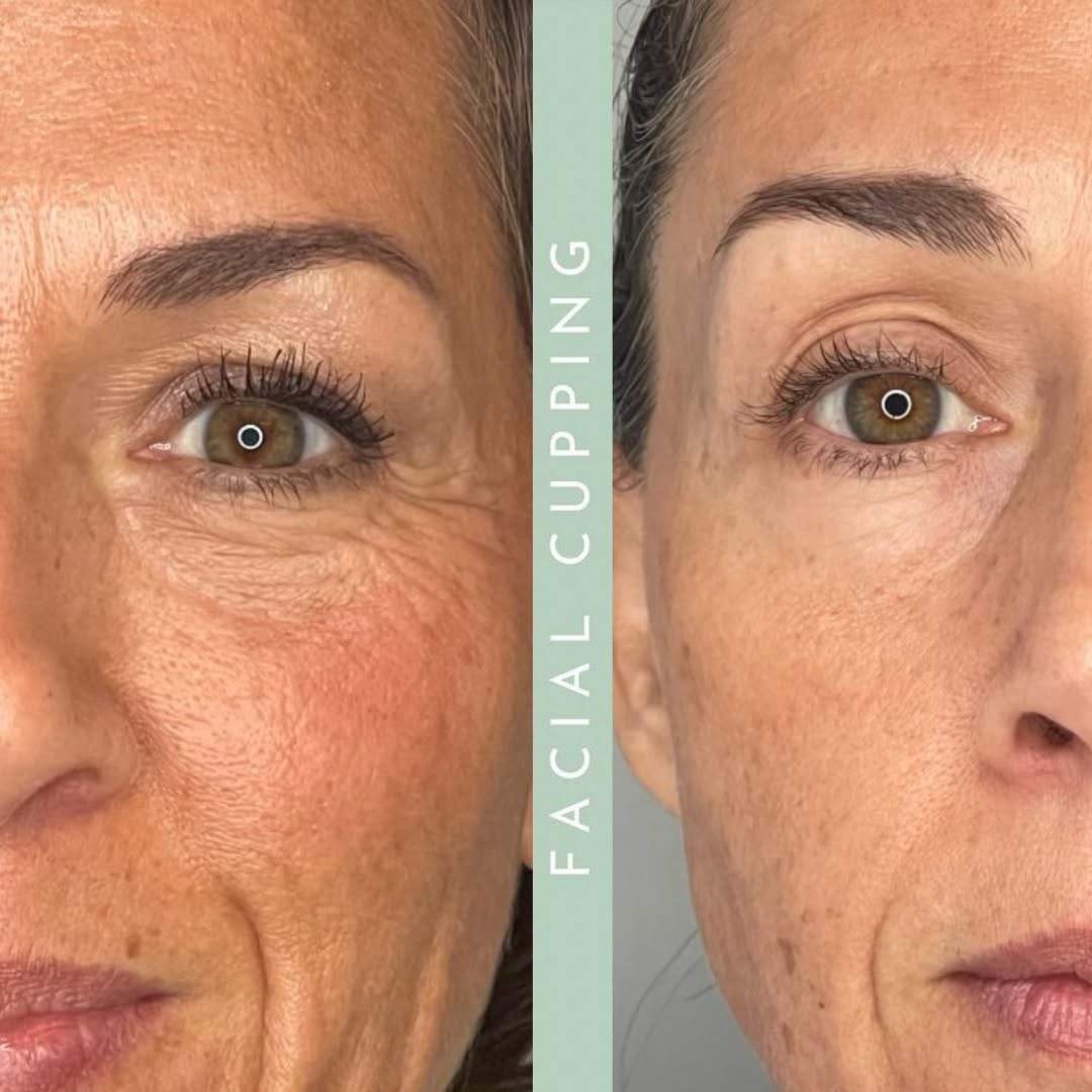 Holy Sculpt™ Facial Cupping Set