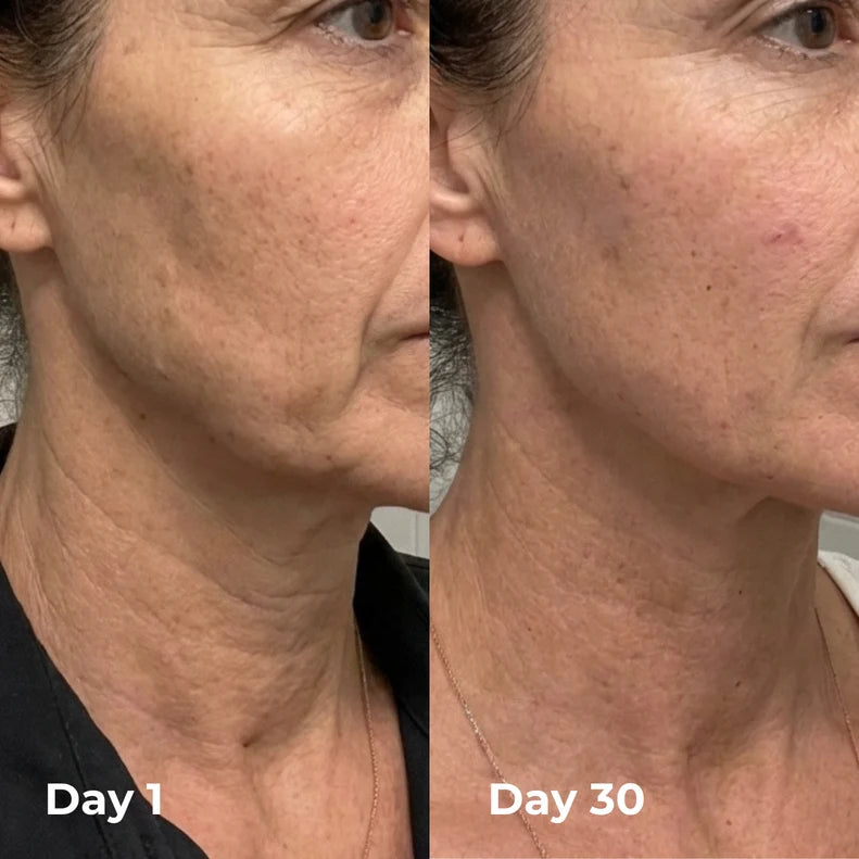 Holy Sculpt™ Facial Cupping Set
